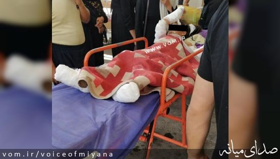 تصویر دختربچه ای که در تعزیه طوق دچار سوختگی شد