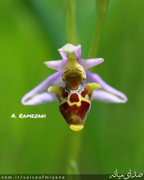 تصویر صدای میانه